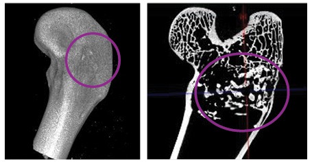 trauma defect model_CT scan